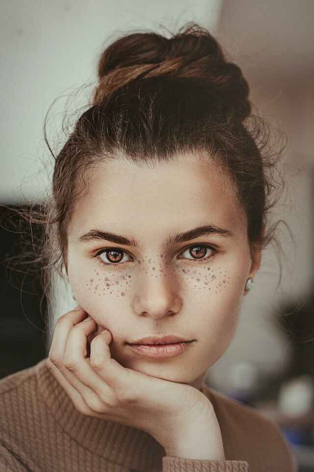 Beautiful Girl with small acne on face 